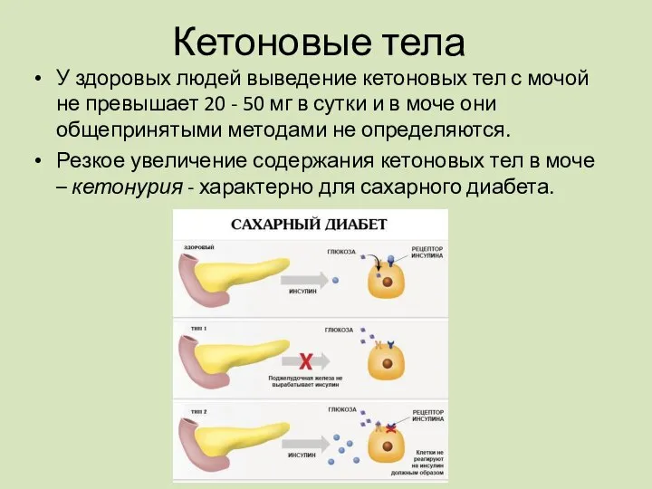 У здоровых людей выведение кетоновых тел с мочой не превышает 20