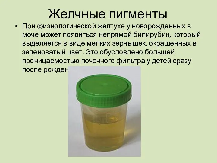 При физиологической желтухе у новорожденных в моче может появиться непрямой билирубин,