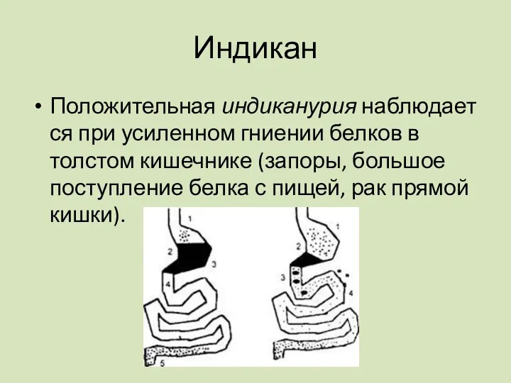 Индикан Положительная индиканурия наблюдается при усиленном гниении белков в толстом кишечнике