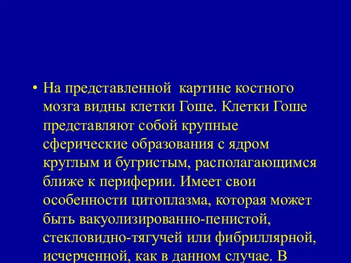 На представленной картине костного мозга видны клетки Гоше. Клетки Гоше представляют