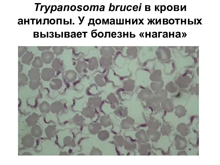 Trypanosoma brucei в крови антилопы. У домашних животных вызывает болезнь «нагана»