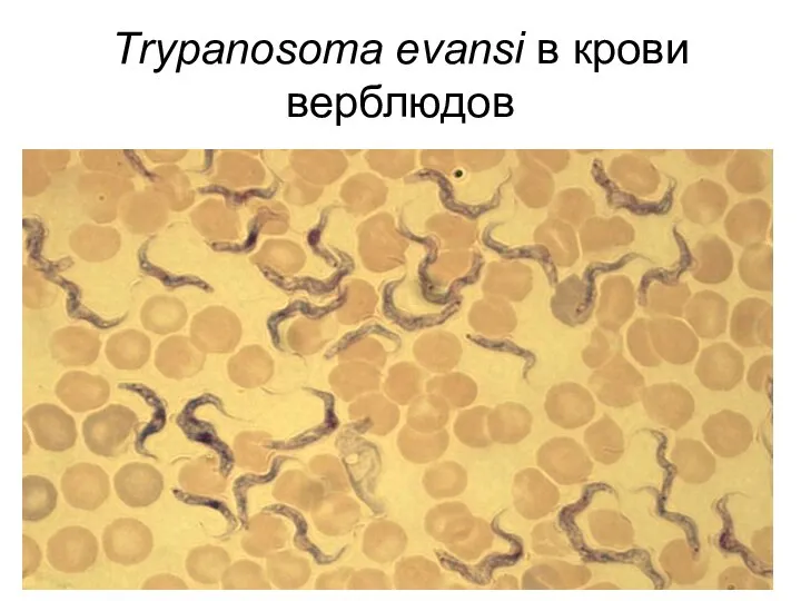 Тrypanosoma evansi в крови верблюдов