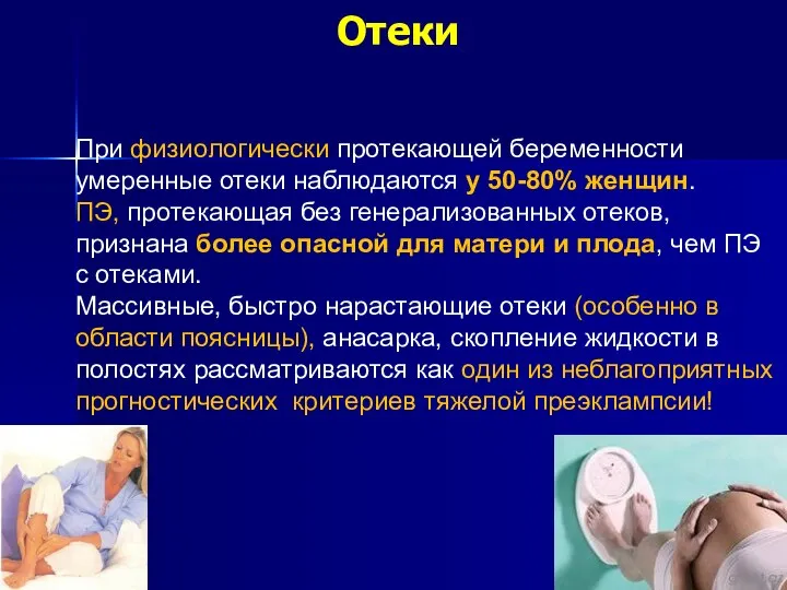 Отеки При физиологически протекающей беременности умеренные отеки наблюдаются у 50-80% женщин.