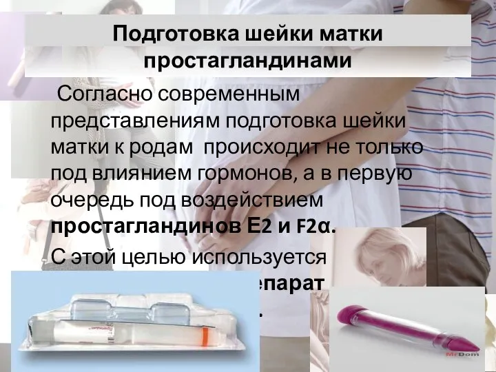 Подготовка шейки матки простагландинами Согласно современным представлениям подготовка шейки матки к