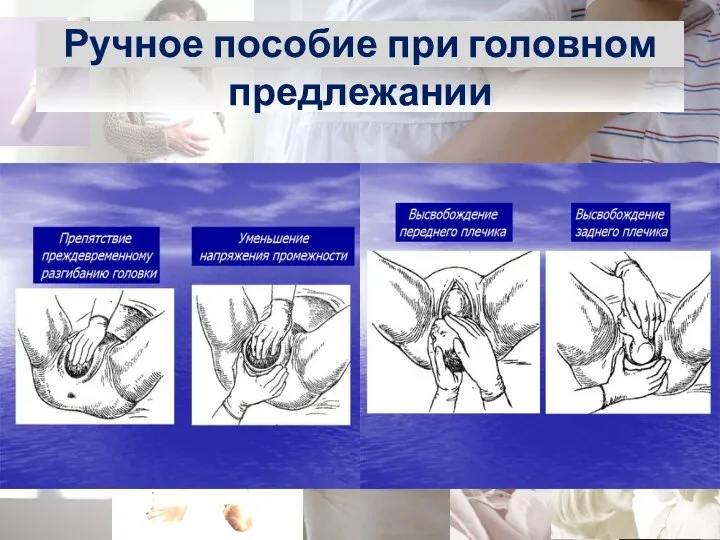 Ручное пособие при головном предлежании