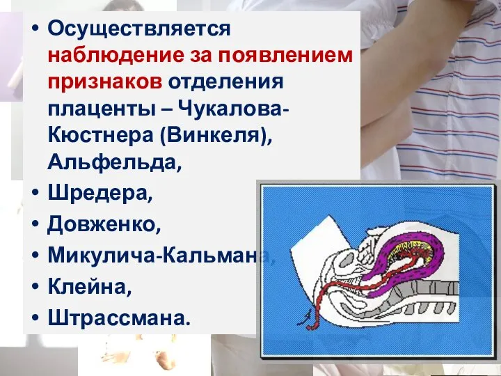 Осуществляется наблюдение за появлением признаков отделения плаценты – Чукалова-Кюстнера (Винкеля), Альфельда, Шредера, Довженко, Микулича-Кальмана, Клейна, Штрассмана.