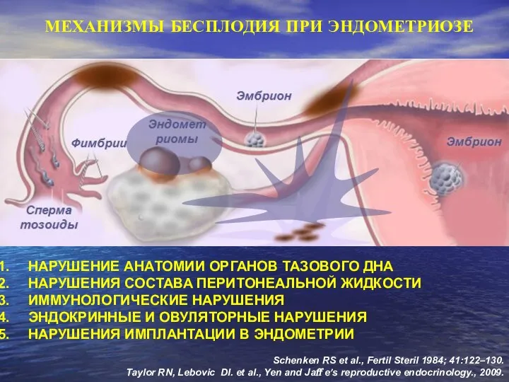 НАРУШЕНИЕ АНАТОМИИ ОРГАНОВ ТАЗОВОГО ДНА НАРУШЕНИЯ СОСТАВА ПЕРИТОНЕАЛЬНОЙ ЖИДКОСТИ ИММУНОЛОГИЧЕСКИЕ НАРУШЕНИЯ