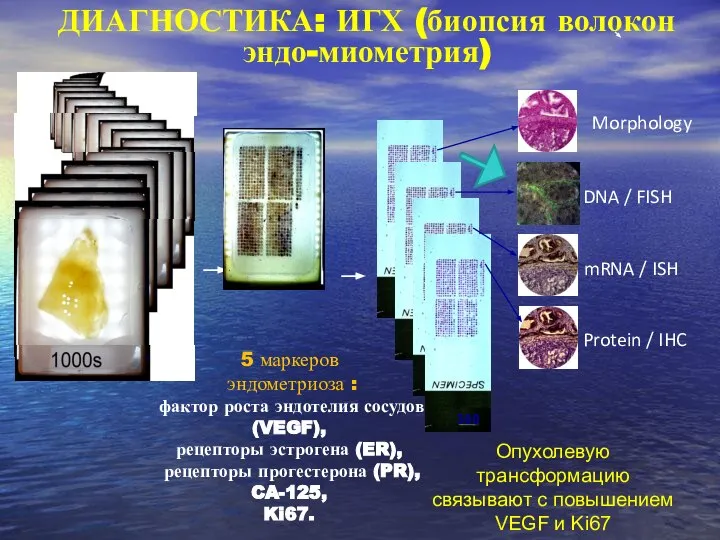 mRNA / ISH Morphology DNA / FISH Protein / IHC 300