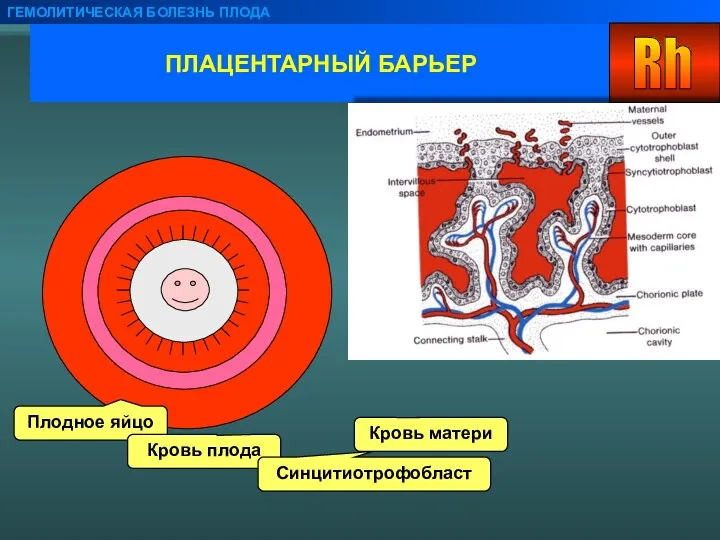 ПЛАЦЕНТАРНЫЙ БАРЬЕР ГЕМОЛИТИЧЕСКАЯ БОЛЕЗНЬ ПЛОДА Плодное яйцо Кровь плода Синцитиотрофобласт Кровь матери