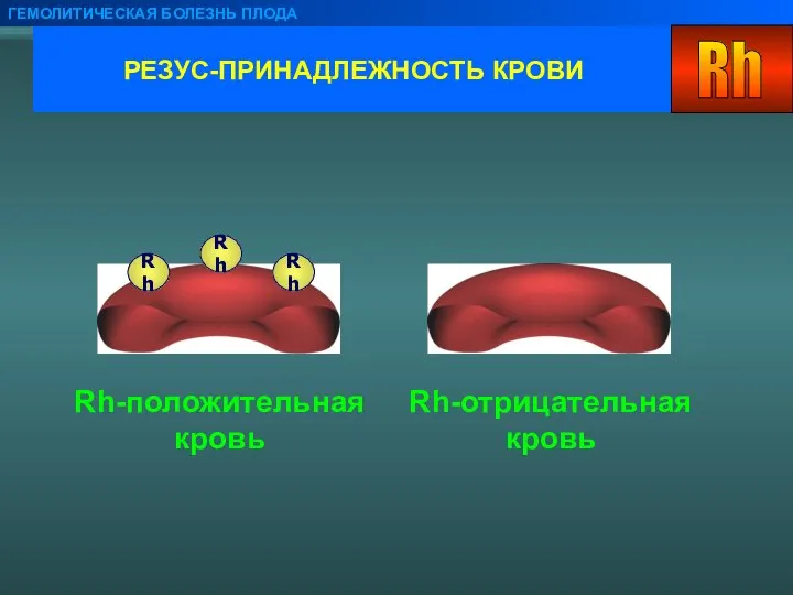 РЕЗУС-ПРИНАДЛЕЖНОСТЬ КРОВИ ГЕМОЛИТИЧЕСКАЯ БОЛЕЗНЬ ПЛОДА Rh-положительная кровь Rh-отрицательная кровь