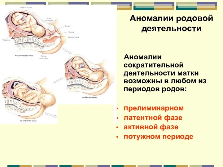 Аномалии родовой деятельности Аномалии сократительной деятельности матки возможны в любом из