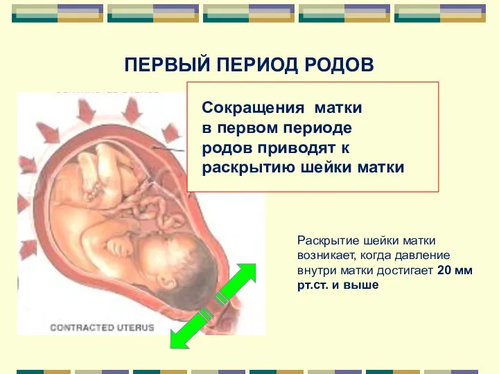 ПЕРВЫЙ ПЕРИОД РОДОВ Сокращения матки в первом периоде родов приводят к