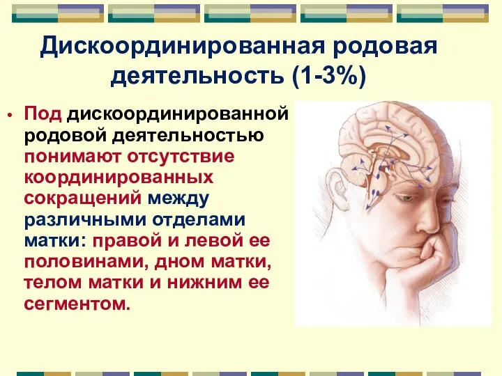 Дискоординированная родовая деятельность (1-3%) Под дискоординированной родовой деятельностью понимают отсутствие координированных