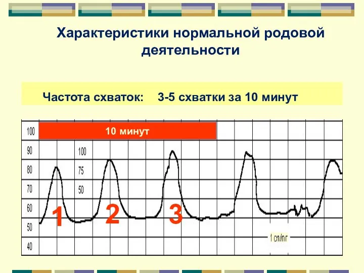 Характеристики нормальной родовой деятельности Частота схваток: 3-5 схватки за 10 минут 10 минут 1 2 3