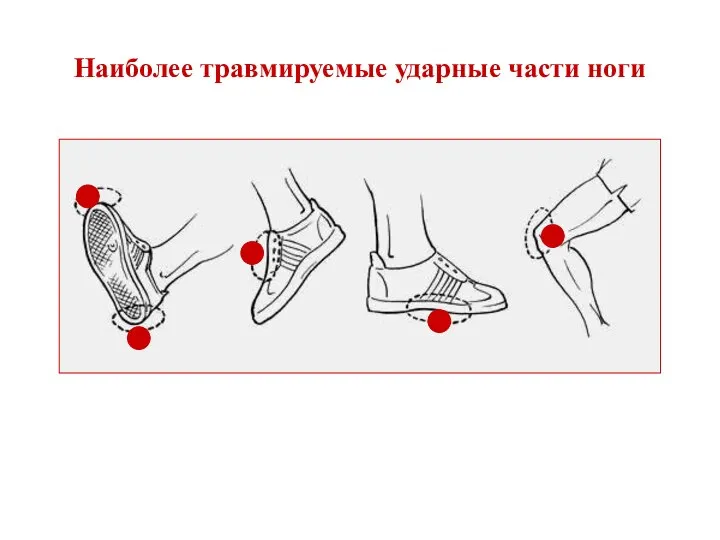 Наиболее травмируемые ударные части ноги