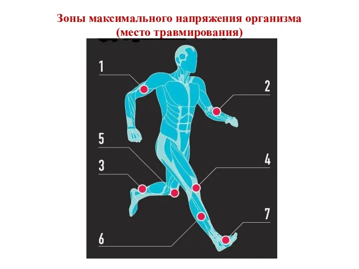 Зоны максимального напряжения организма (место травмирования)