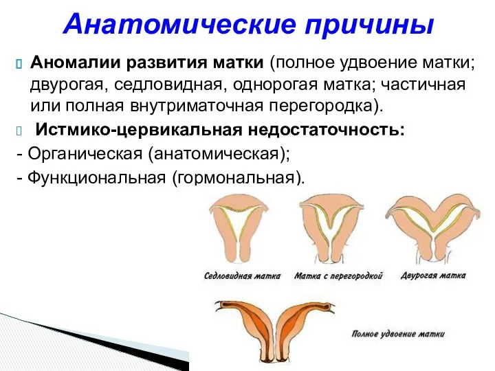 Аномалии развития матки (полное удвоение матки; двурогая, седловидная, однорогая матка; частичная