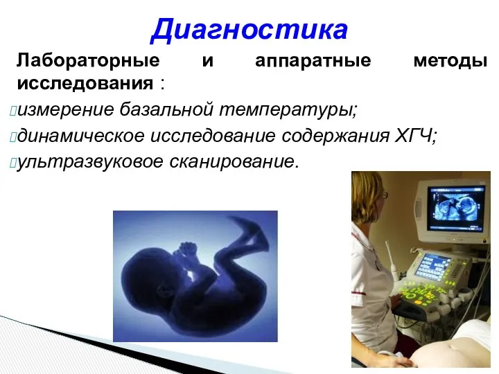 Лабораторные и аппаратные методы исследования : измерение базальной температуры; динамическое исследование содержания ХГЧ; ультразвуковое сканирование. Диагностика