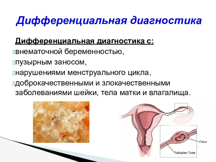 Дифференциальная диагностика с: внематочной беременностью, пузырным заносом, нарушениями менструального цикла, доброкачественными