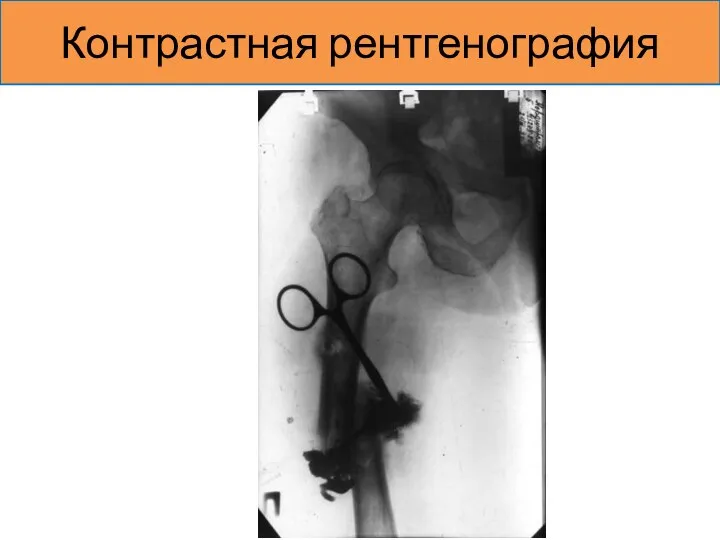 Контрастная рентгенография