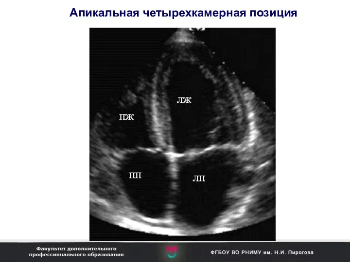 Апикальная четырехкамерная позиция