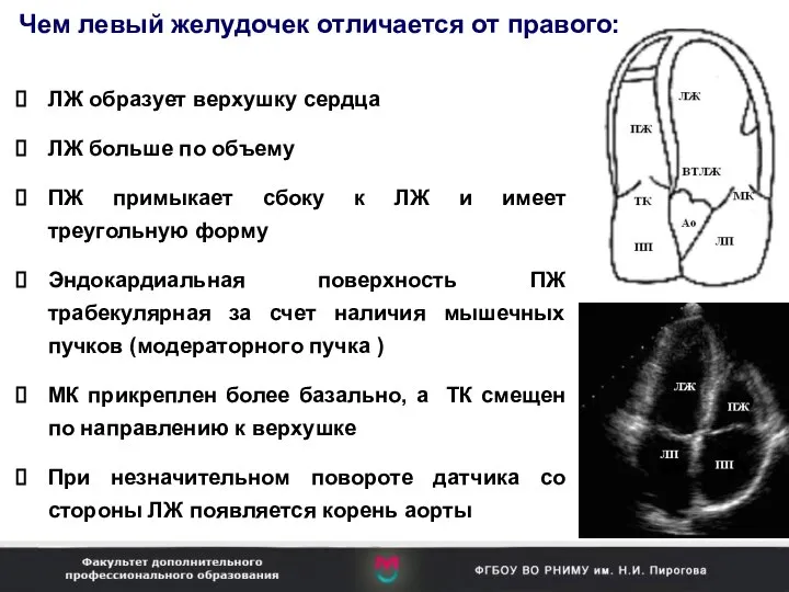 ЛЖ образует верхушку сердца ЛЖ больше по объему ПЖ примыкает сбоку