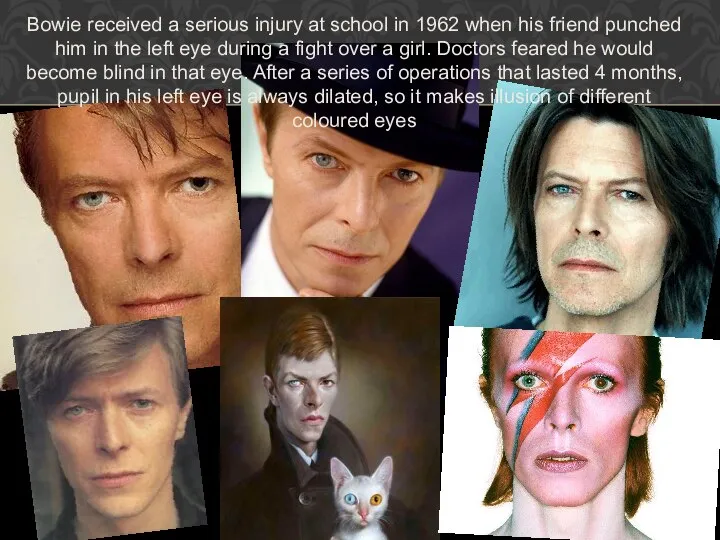 Bowie received a serious injury at school in 1962 when his