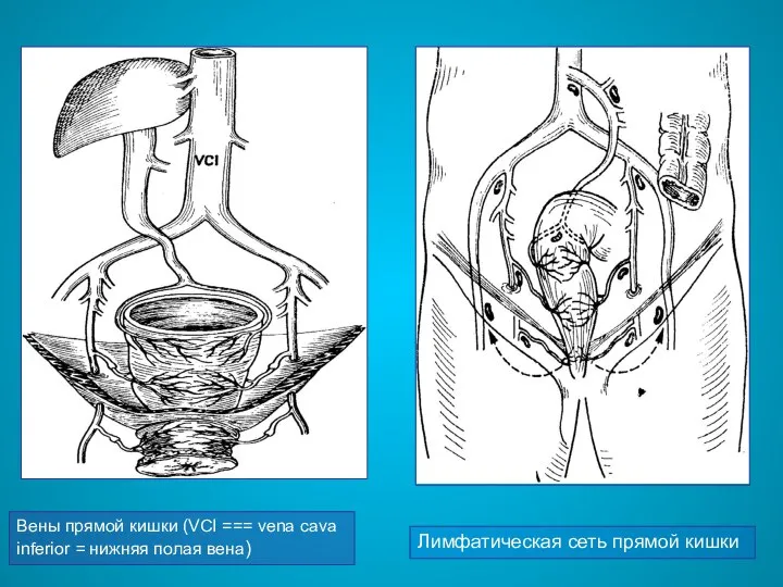 Вены прямой кишки (VCI === vena cava inferior = нижняя полая вена) Лимфатическая сеть прямой кишки