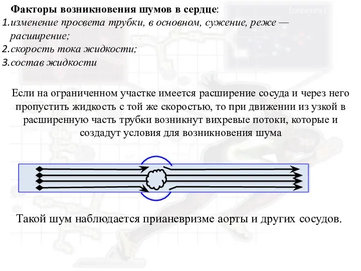 Факторы возникновения шумов в сердце: изменение просвета трубки, в основном, сужение,