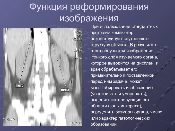 Функция реформирования изображения При использовании стандартных программ компьютер реконструирует внутреннюю структуру