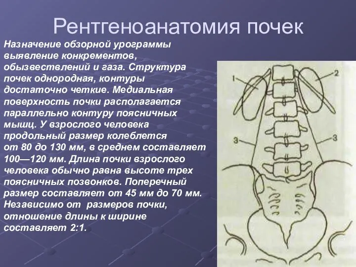 Рентгеноанатомия почек Назначение обзорной урограммы выявление конкрементов, обызвествлений и газа. Структура