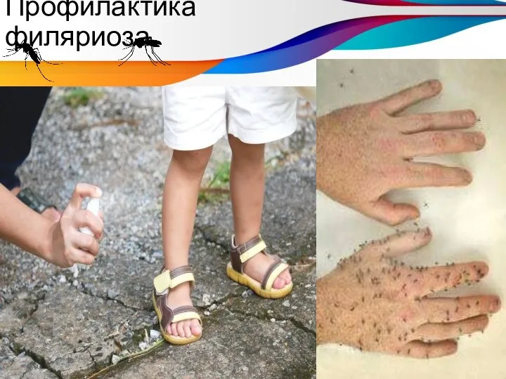 Профилактика филяриоза