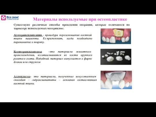 Материалы используемые при остеопластике Существуют различные способы проведения операции, которые отличаются