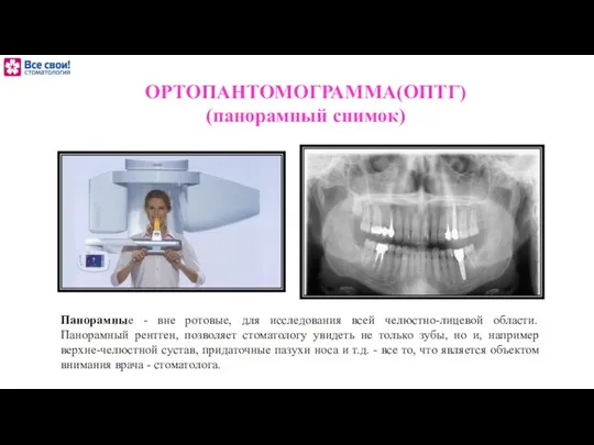 ОРТОПАНТОМОГРАММА(ОПТГ) (панорамный снимок) Панорамные - вне ротовые, для исследования всей челюстно-лицевой