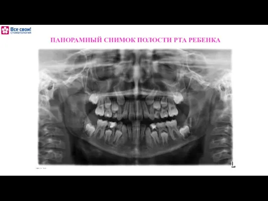 ПАНОРАМНЫЙ СНИМОК ПОЛОСТИ РТА РЕБЕНКА