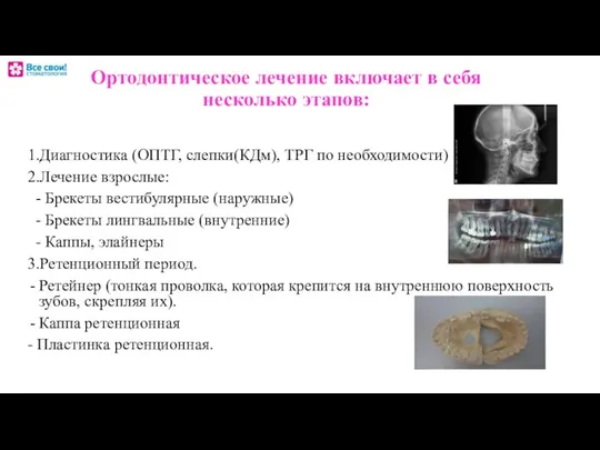 Ортодонтическое лечение включает в себя несколько этапов: 1.Диагностика (ОПТГ, слепки(КДм), ТРГ