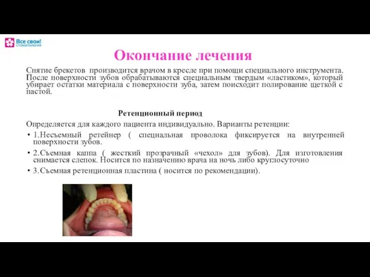 Окончание лечения Снятие брекетов производится врачом в кресле при помощи специального