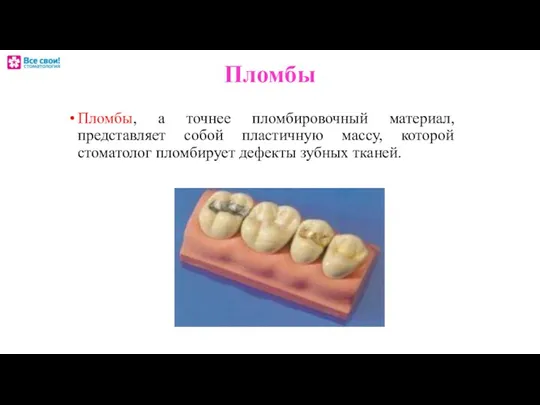 Пломбы Пломбы, а точнее пломбировочный материал, представляет собой пластичную массу, которой стоматолог пломбирует дефекты зубных тканей.