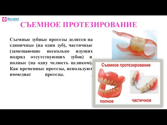 СЪЕМНОЕ ПРОТЕЗИРОВАНИЕ Съемные зубные протезы делятся на единичные (на один зуб),