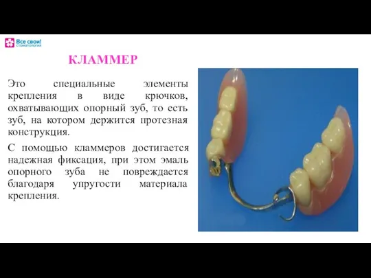 КЛАММЕР Это специальные элементы крепления в виде крючков, охватывающих опорный зуб,