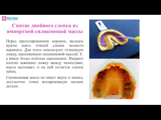 Снятие двойного слепка из импортной силиконовой массы Перед протезированием коронок, вкладок