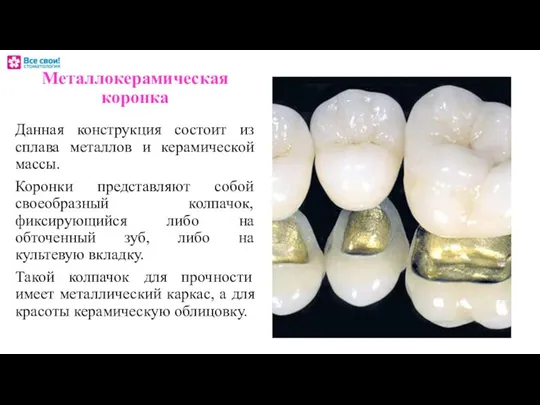 Металлокерамическая коронка Данная конструкция состоит из сплава металлов и керамической массы.