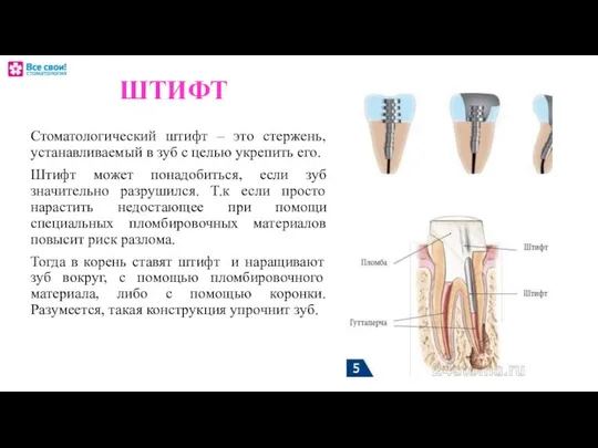 ШТИФТ Стоматологический штифт – это стержень, устанавливаемый в зуб с целью