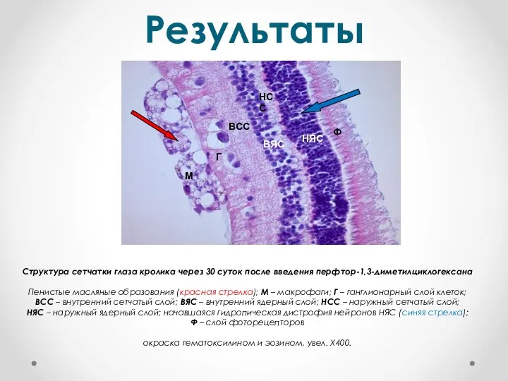 Результаты Ф ВСС ВЯС НЯС Г НСС М Структура сетчатки глаза