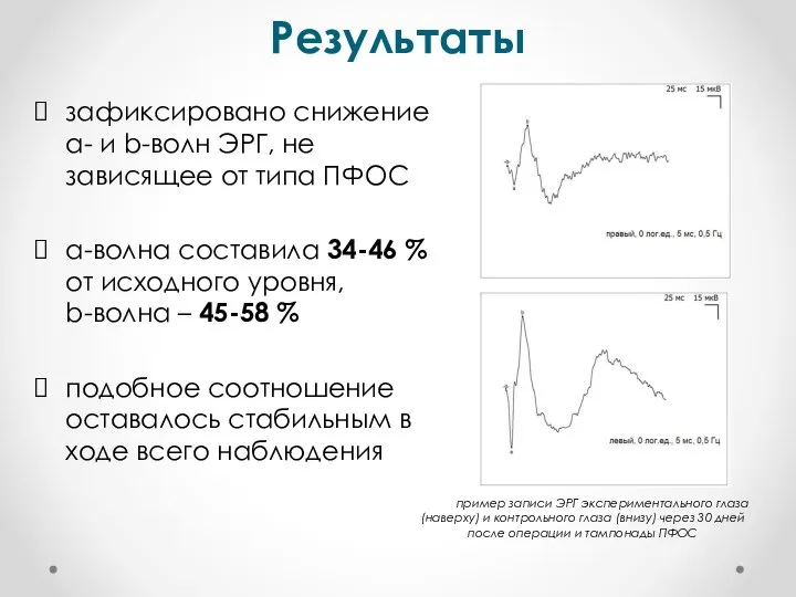 Результаты зафиксировано снижение а- и b-волн ЭРГ, не зависящее от типа