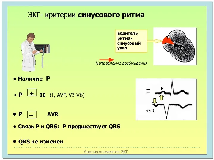 Анализ элементов ЭКГ водитель ритма- синусовый узел ЭКГ- критерии синусового ритма Р II AVR Направление возбуждения