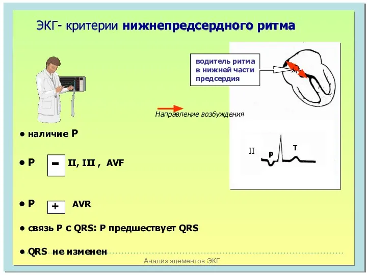 Анализ элементов ЭКГ ЭКГ- критерии нижнепредсердного ритма II P T водитель