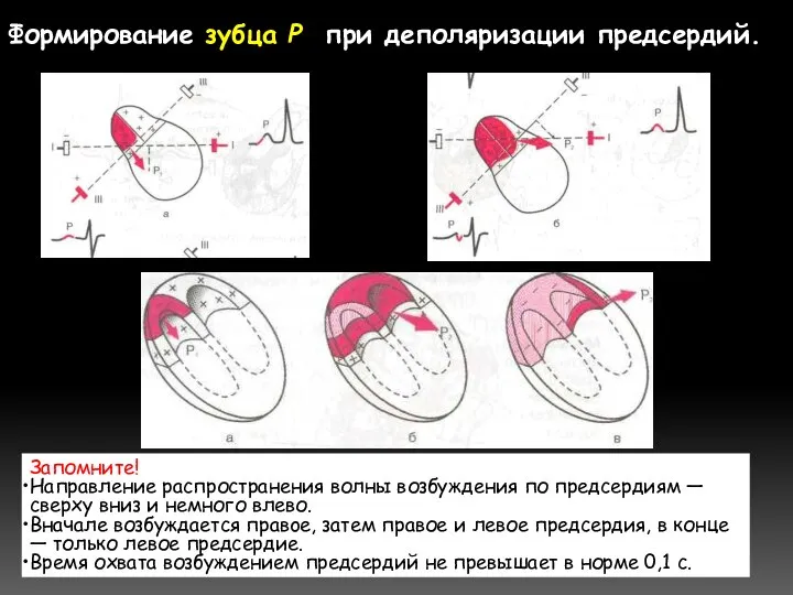 Формирование зубца Р при деполяризации предсердий. Запомните! Направление распространения волны возбуждения