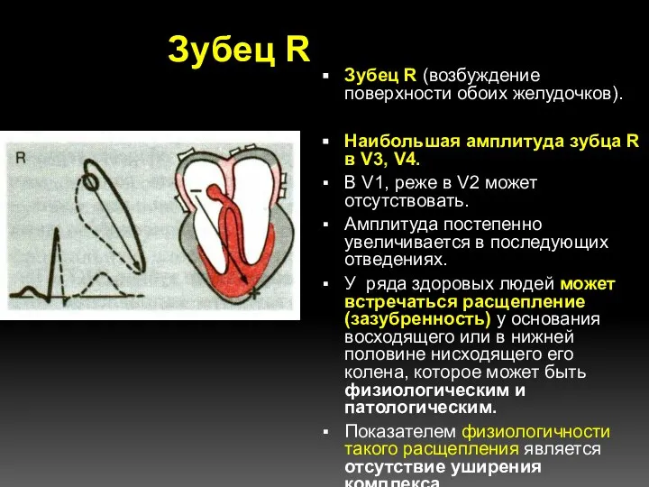 Зубец R Зубец R (возбуждение поверхности обоих желудочков). Наибольшая амплитуда зубца
