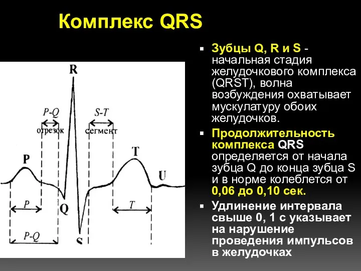 Комплекс QRS Зубцы Q, R и S - начальная стадия желудочкового